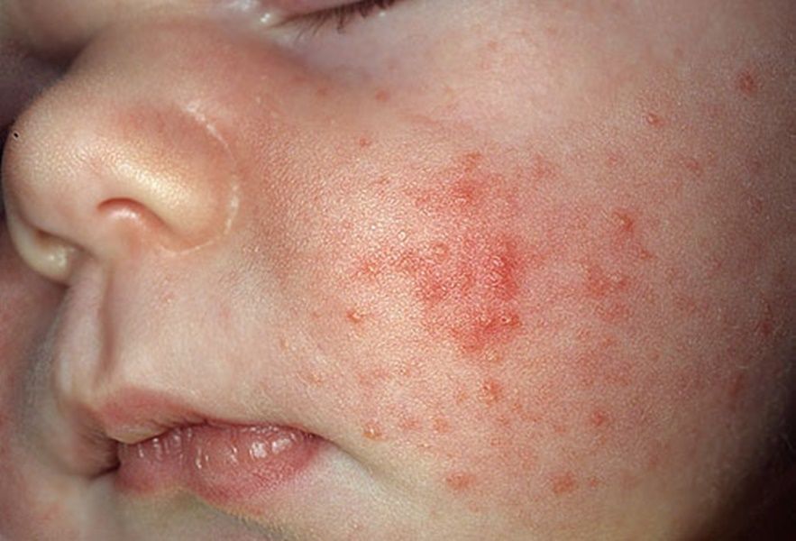 La cura di problema affronta mezzi di farmaco della pelle