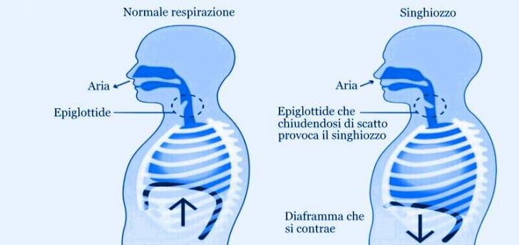 Operazione di cancro alla mammella di 1 grado
