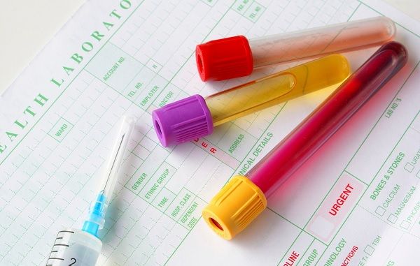 Unguento di orecchio da eczema