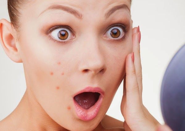 Posti sulla faccia alla ragazza di 16 anni