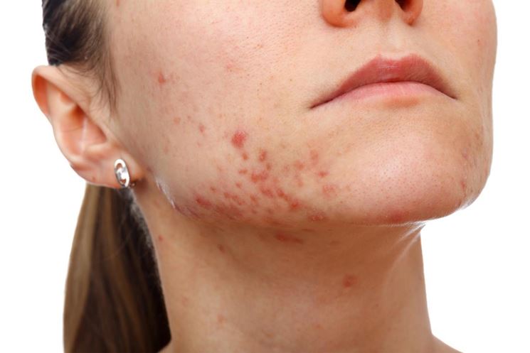 Da dietro del quale i posti di prodotti sulla faccia appaiono