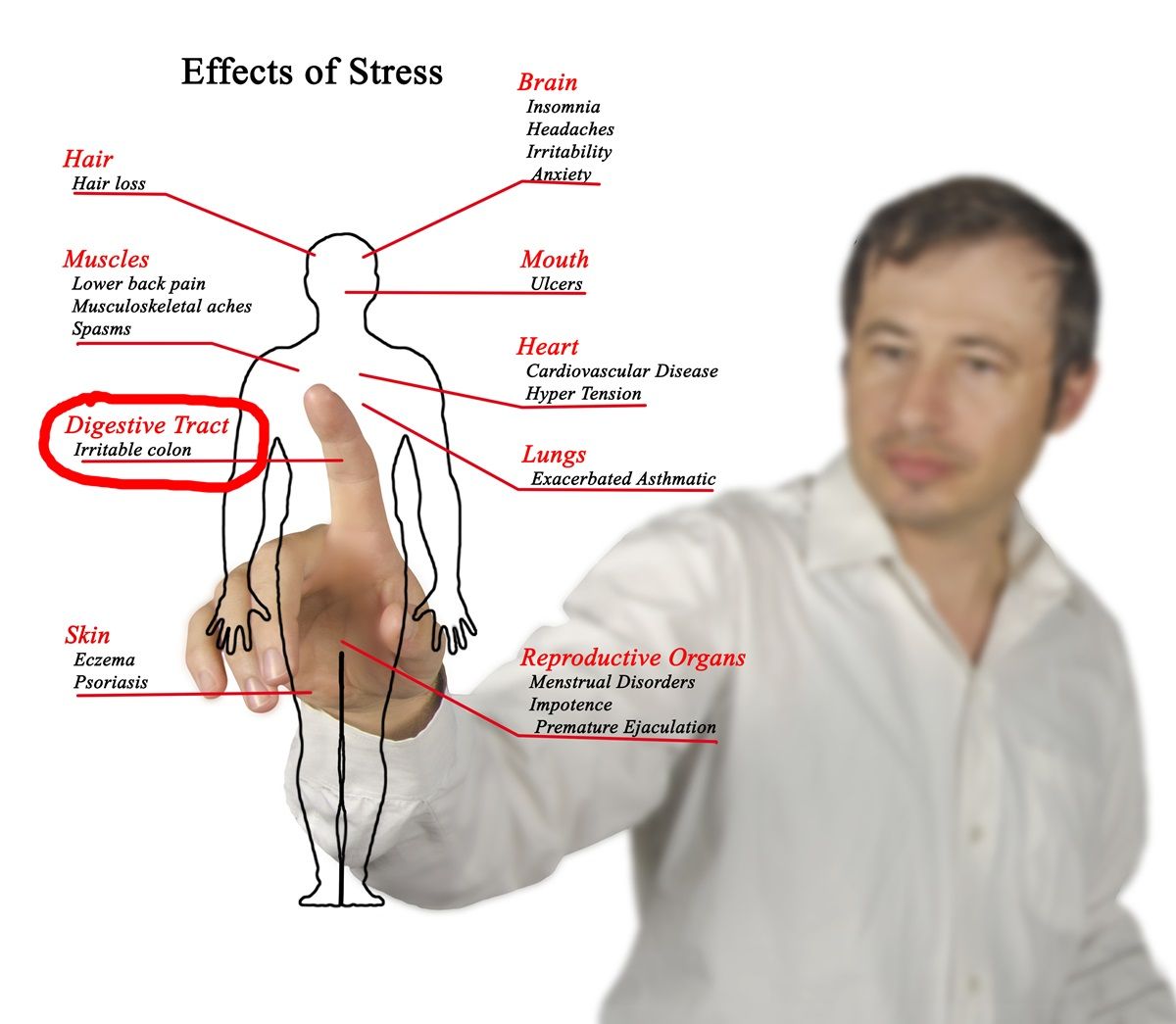 Sindrome del colon irritabile o colite: sintomi, dieta ...