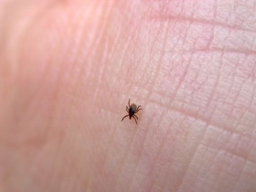 Fare prove su helminths in Rostov su Don