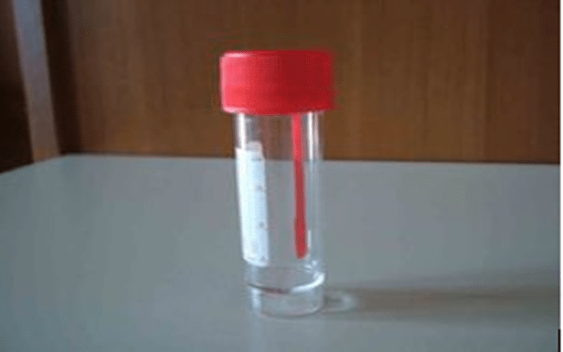 Quanti Kg Di Feci Puo Contenere L Intestino