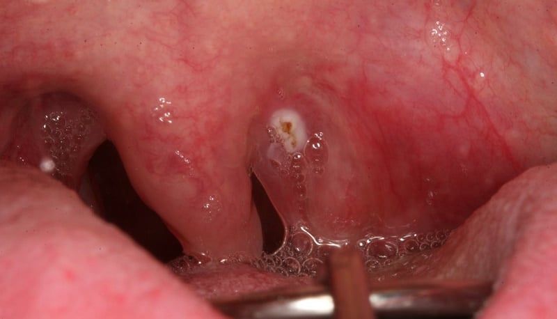 Le medicine per migliorare la circolazione del sangue il reparto cervicale