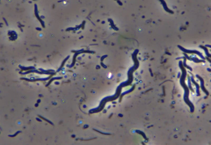 Leptospirosi, sindrome infettiva molto difficile da diagnosticare