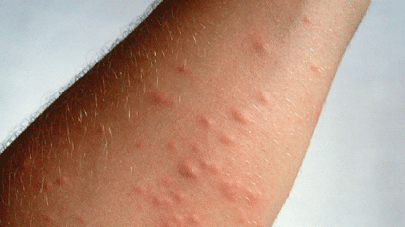 Si Puo Essere Allergici Allo Sperma