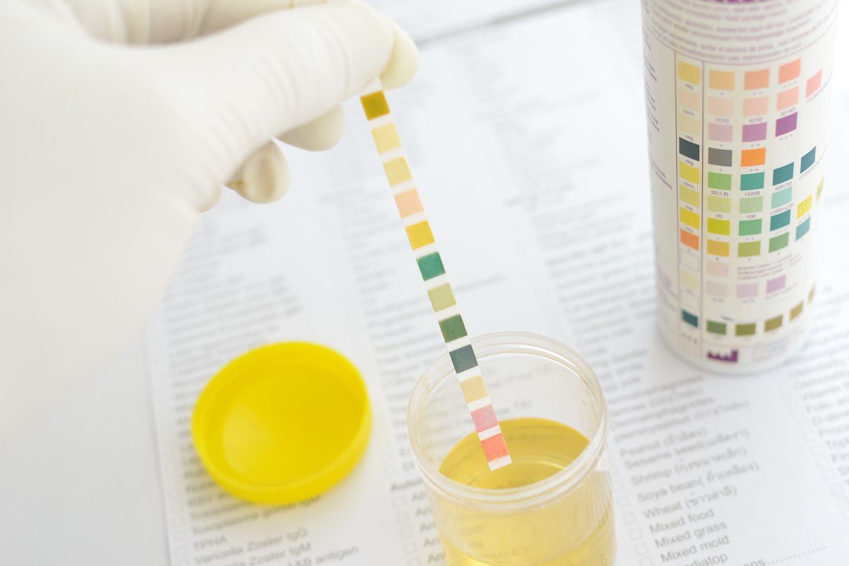 Leucociti nelle urine, caratteristiche e cause