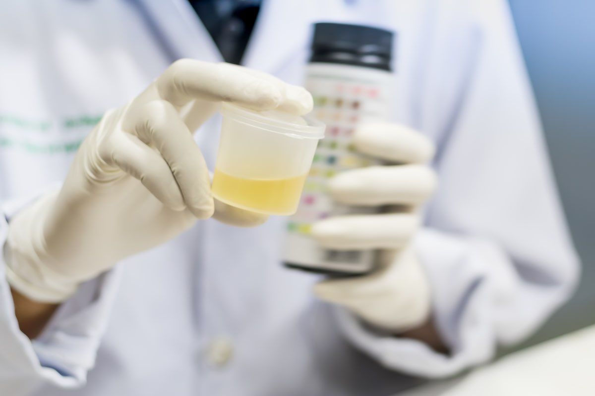 analisi delle urine