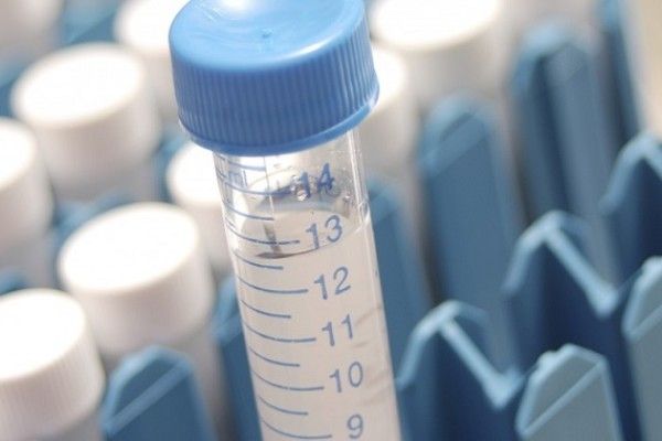 Sangue dopo defecazione alla donna incinta da una vagina
