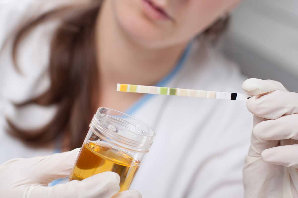 Perché si misurano i nitriti nelle urine