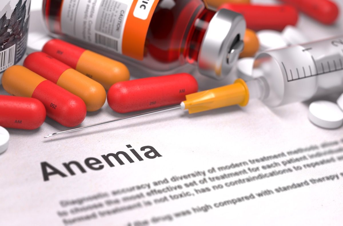 Anemia aplastica