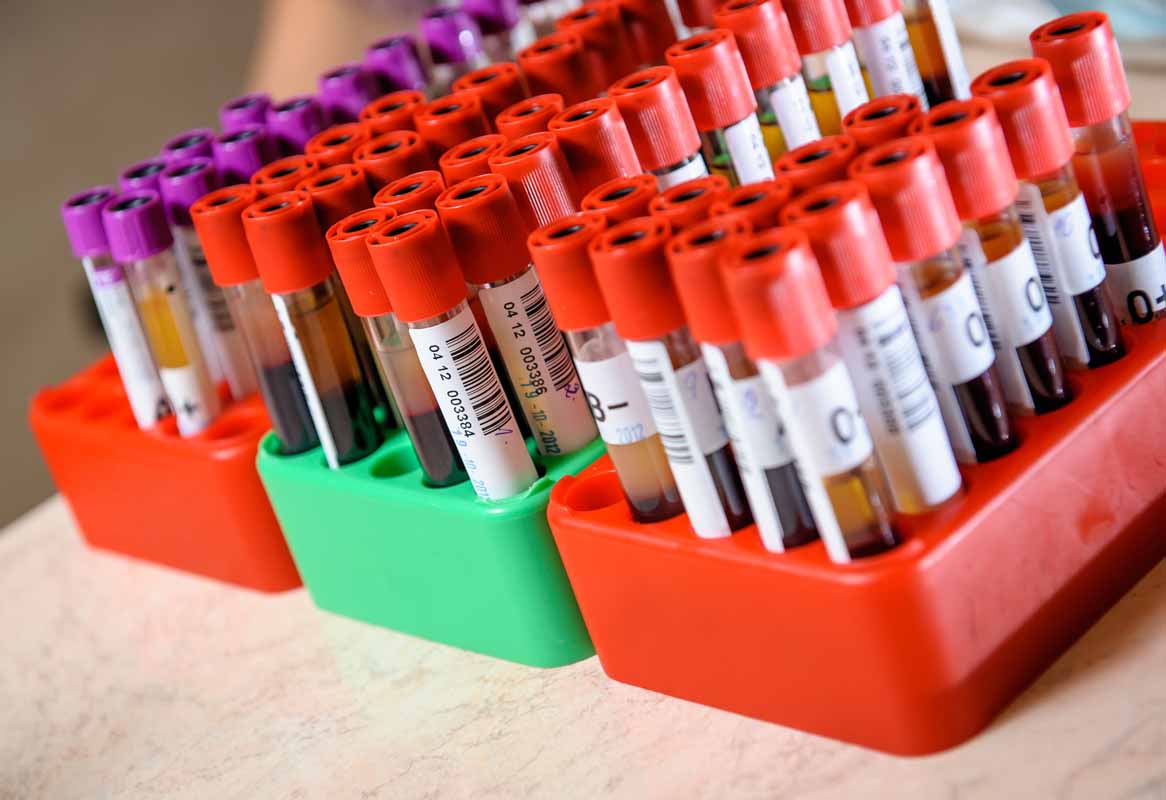 Ferritina alta no sangue dieta