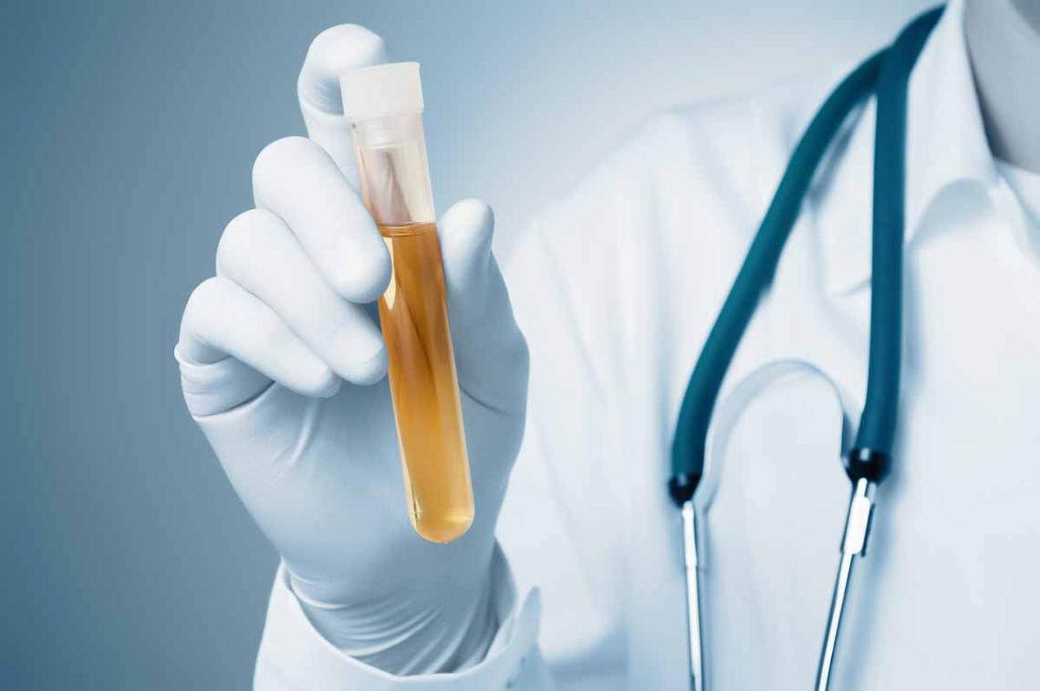 Urine torbide come riconoscerle e da cosa può dipendere