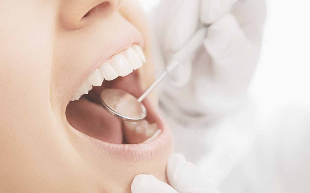 Brev(issim)i cenni sull’anatomia di un dente