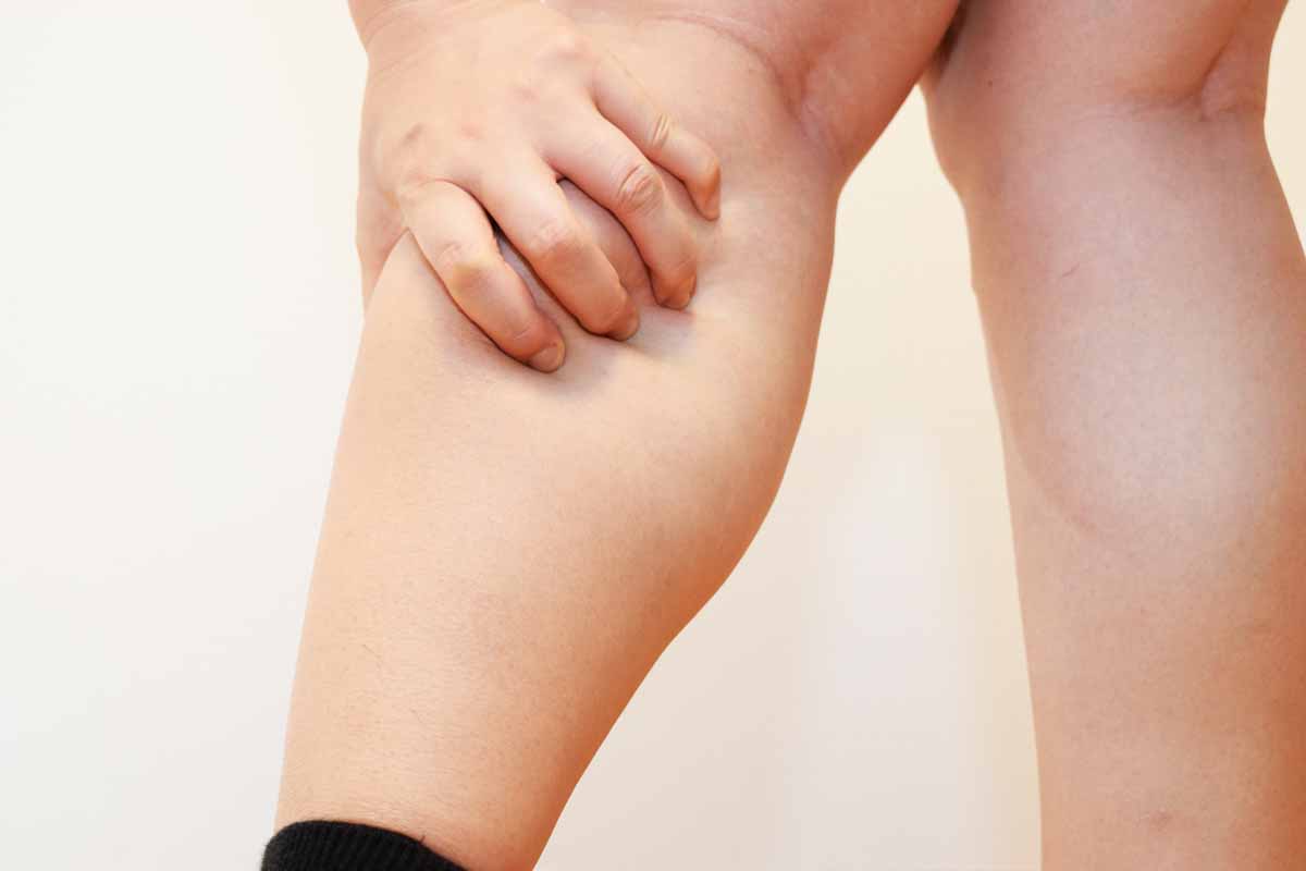 Altre cause e diagnosi per le gambe grosse