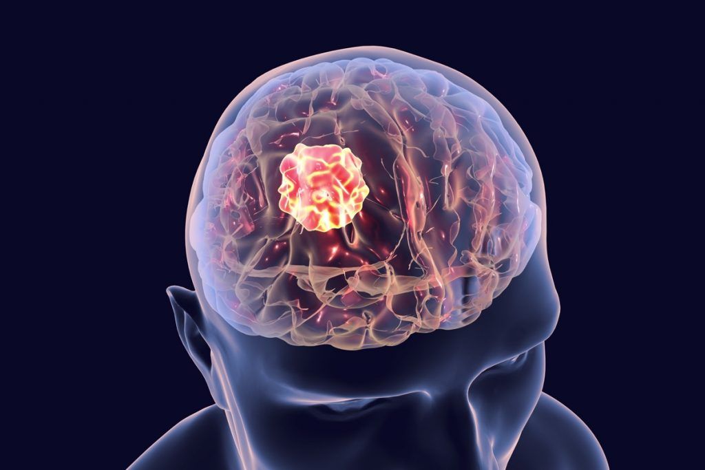 Infiammazione del trigemino, da cosa è causata? – INRAN.IT