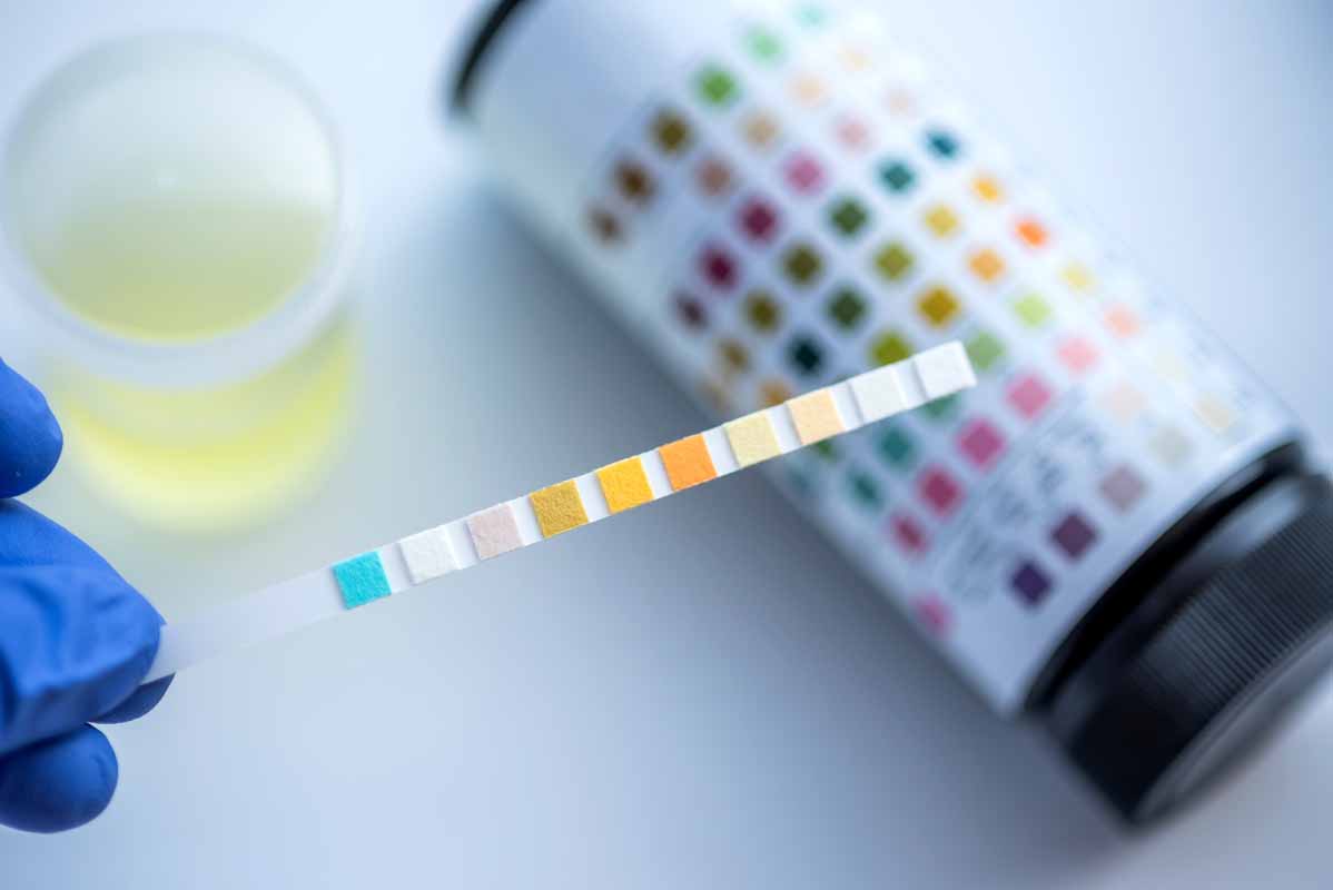 Cause e fattori di rischio dell’infezione vie urinarie