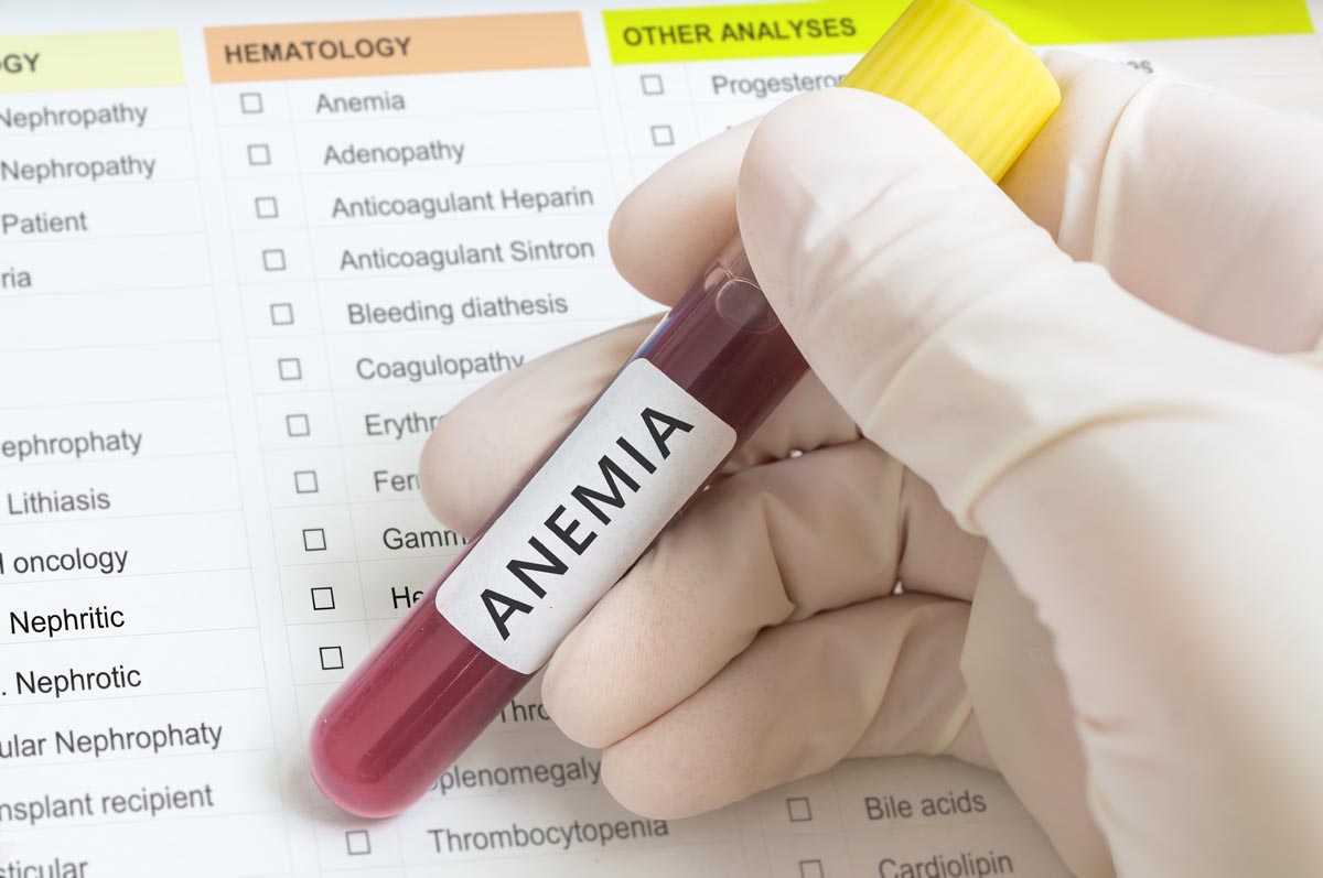  Anemia sideropenica cibi consigliati