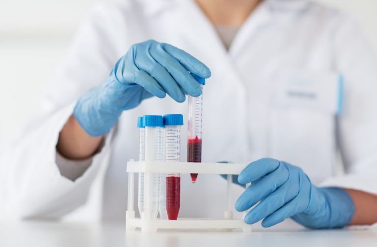 Analisi delle urine e l'importanza del peso specifico Analisi delle urine e l'importanza del peso specifico