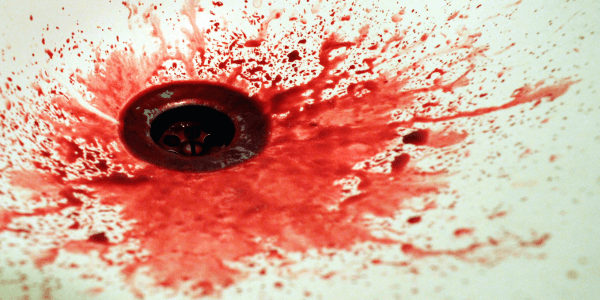 come togliere le macchie di sangue