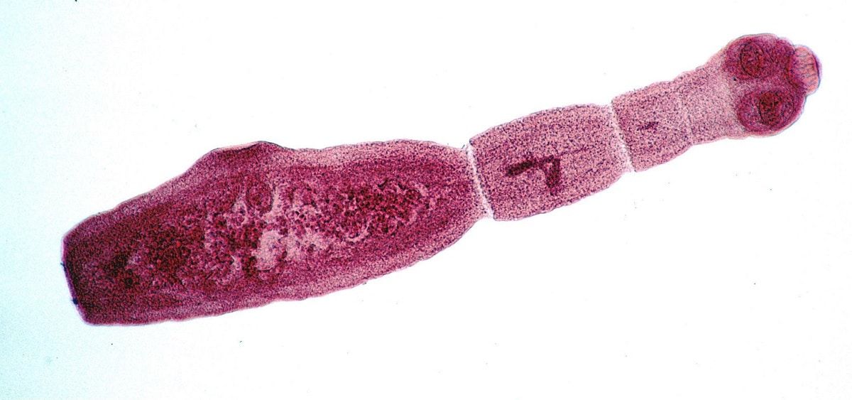 Echinococco 1 Echinococco