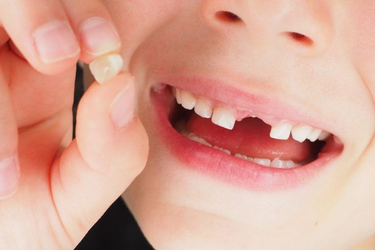 Sognare Di Togliersi Un Dente Smorfia