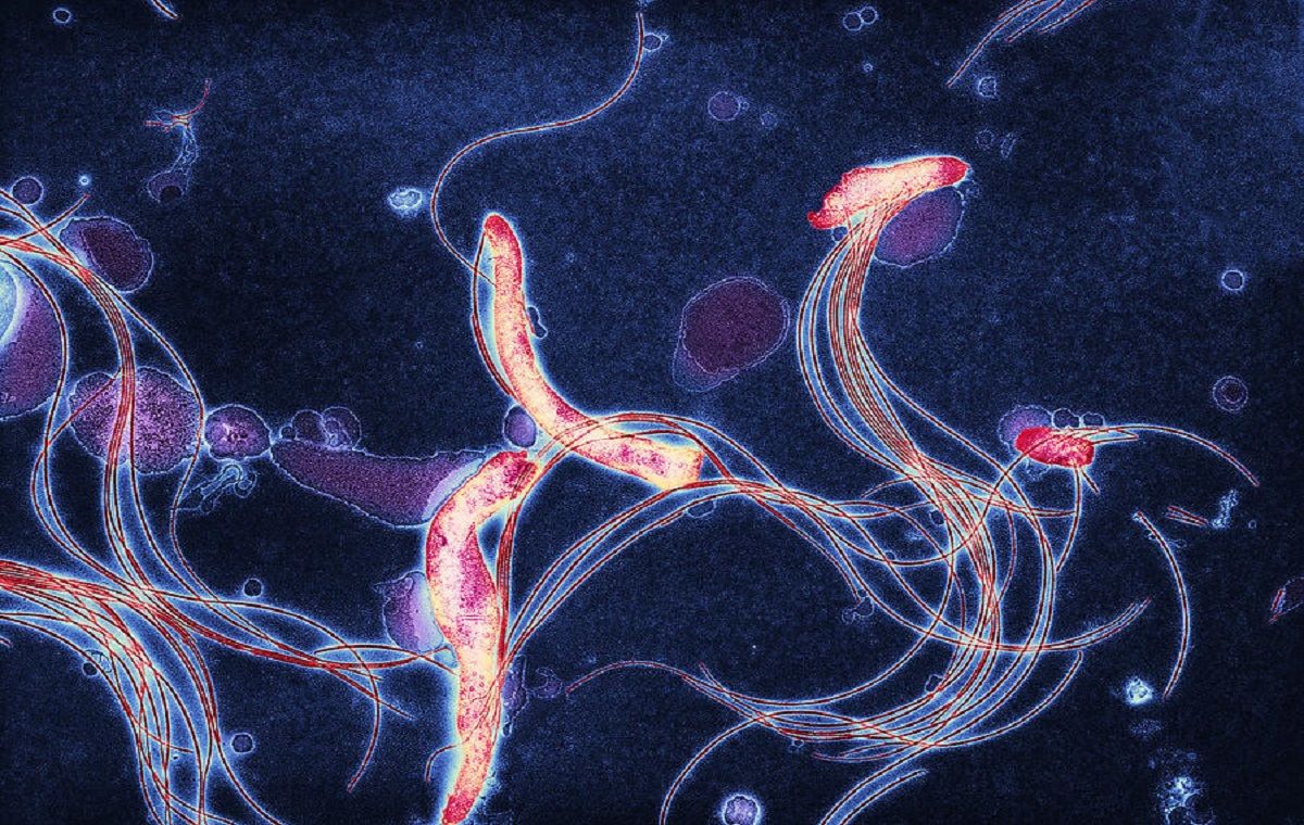 Leptospirosi, sindrome infettiva molto difficile da diagnosticare