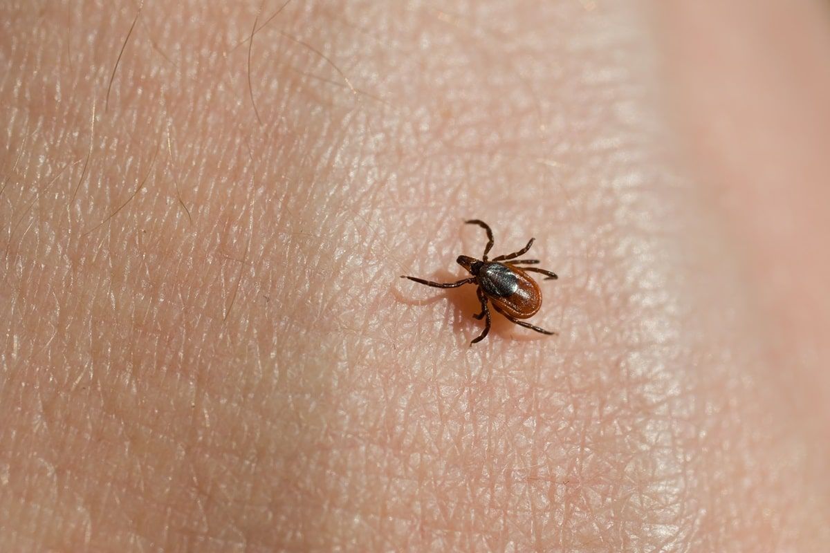 borreliosi