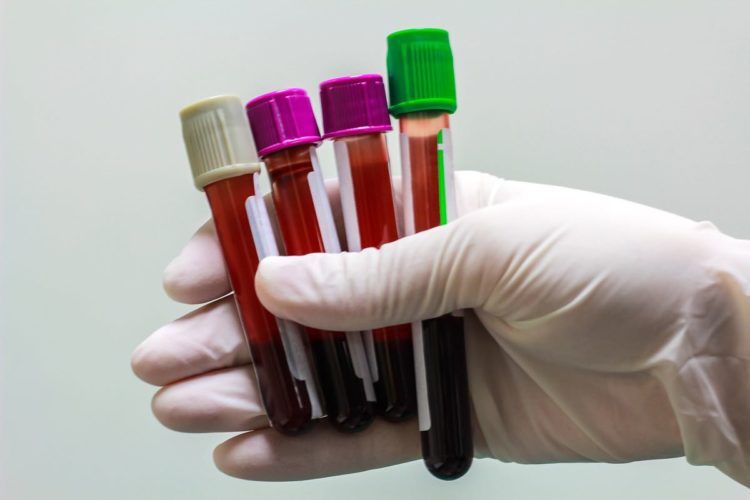 parola medica per minzione frequente parola medica per minzione frequente