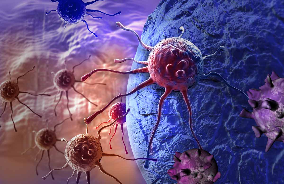 Quali sono le principali tipologie di amiloidosi