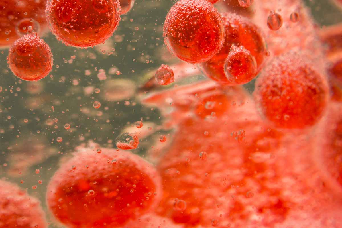 Diagnosticare l'embolia