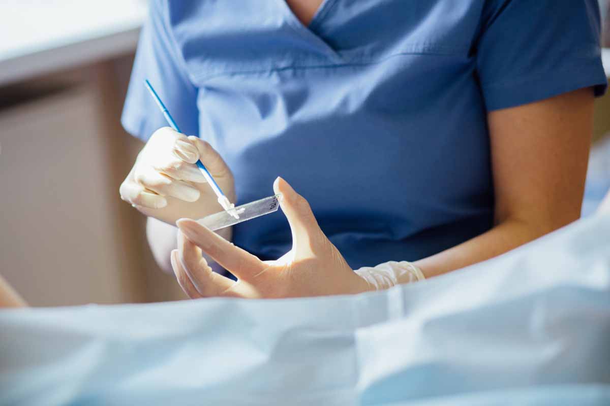 Pap Test La Diagnosi Precoce Dei Tumori Al Collo Dellutero