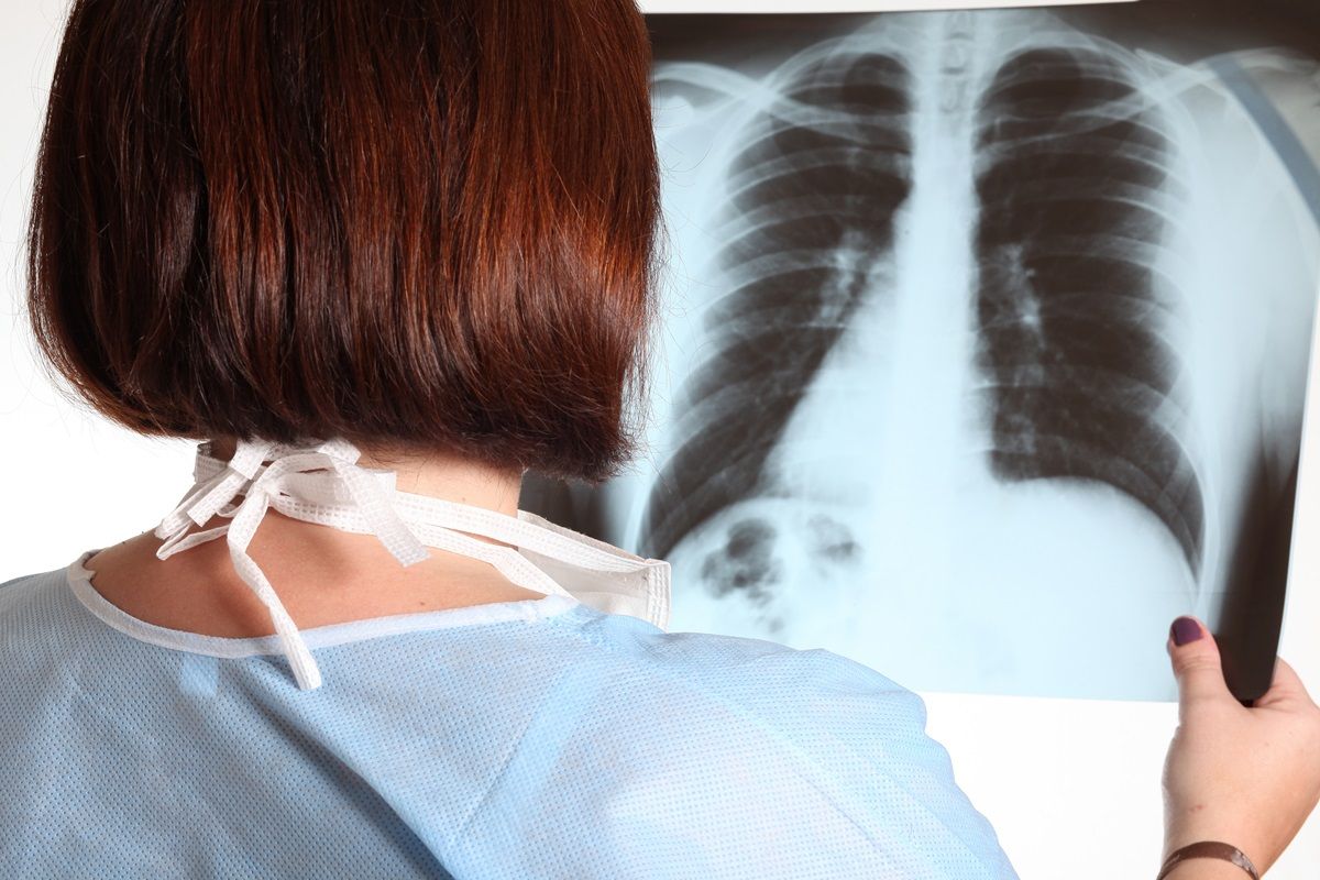 iocattolo scambiato per un tumore al polmone: le testimonianze dei medici