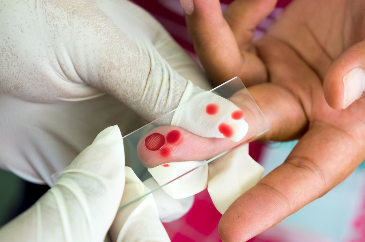 Le analisi del sangue per la malaria