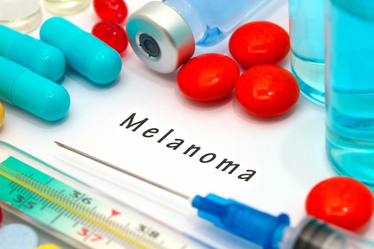 studio sul propanolo contro il melanoma: come è stato condotto