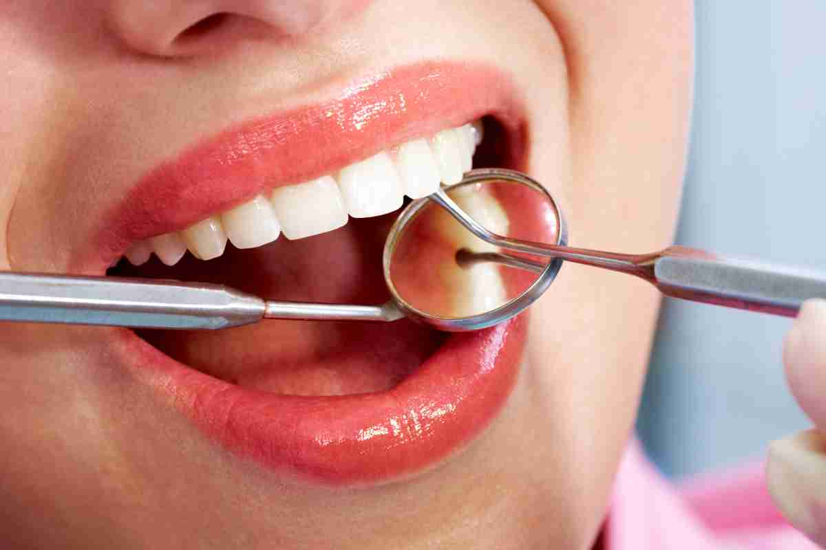 pulizia dei denti