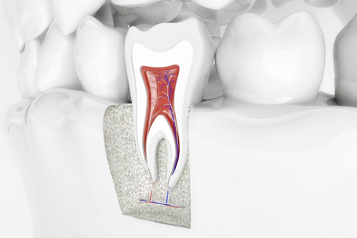 Alveolite, infiammazione della gengiva