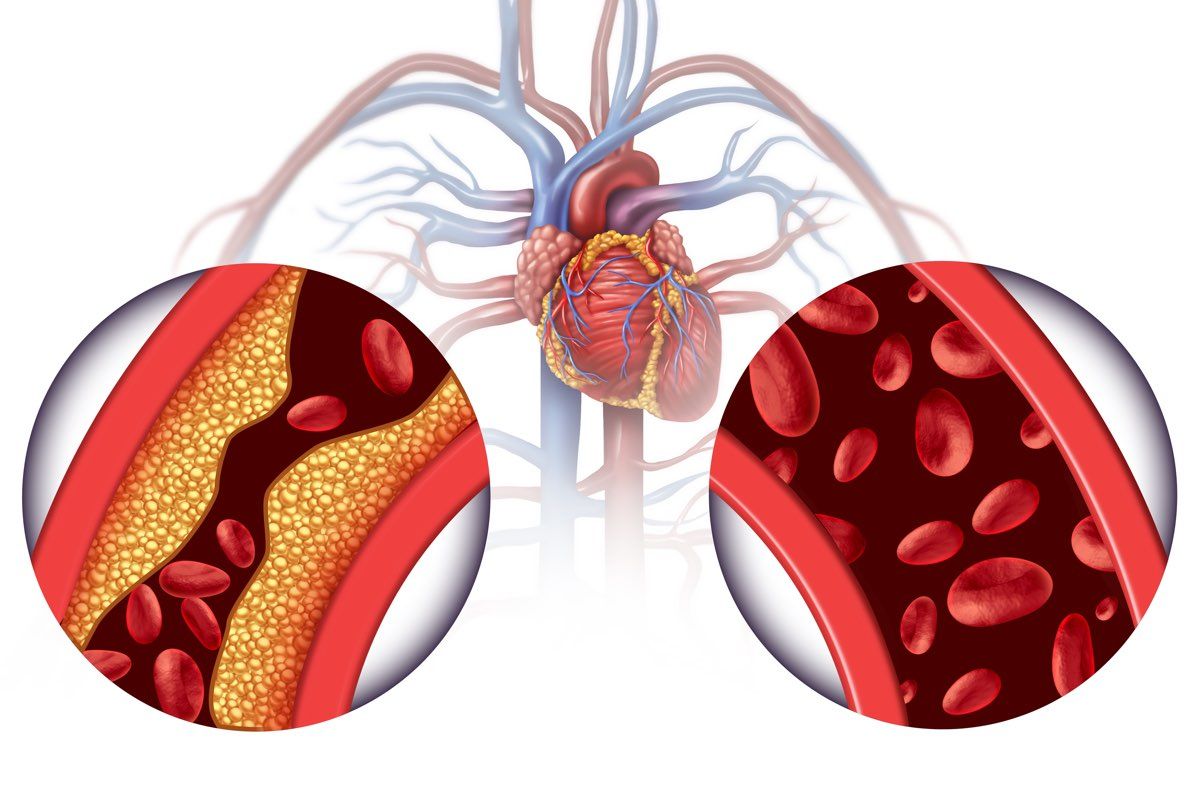 Effetti collaterali e precauzioni degli Ace inibitori