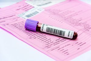 Immunoglubine