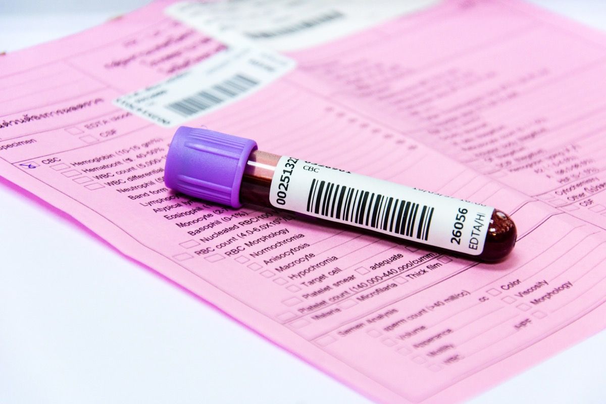 Immunoglubine