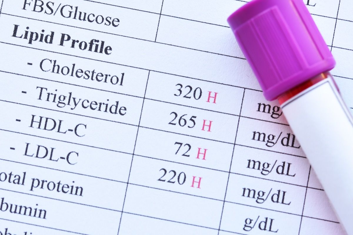 Quali sono le classi di immunoglubine