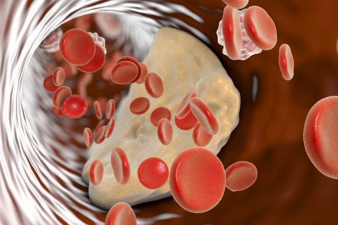 Aorta addominale Aorta addominale