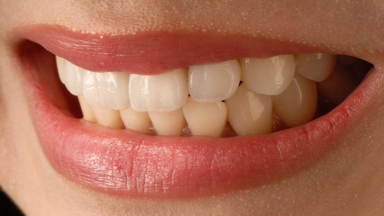 sognare perdere denti sogno sogni significato