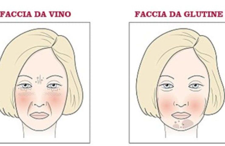 effetti dell'alimentazione sul viso