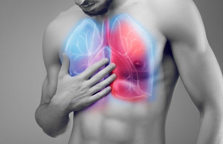 Edema polmonare: i sintomi