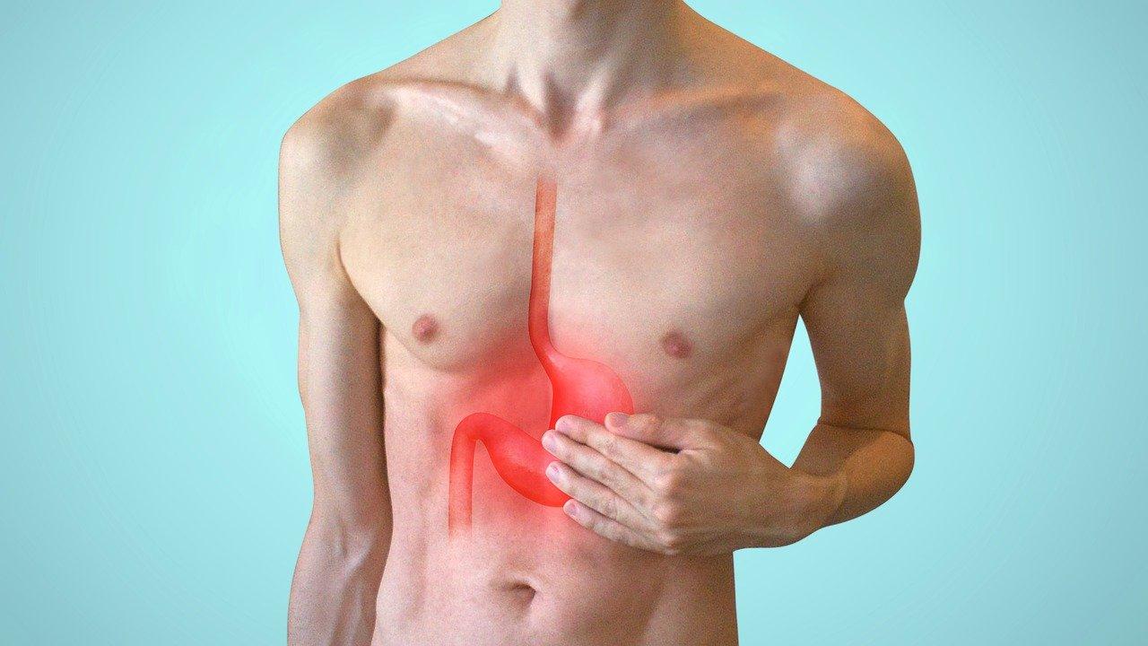 Acidità di stomaco, sintomi e rimedi