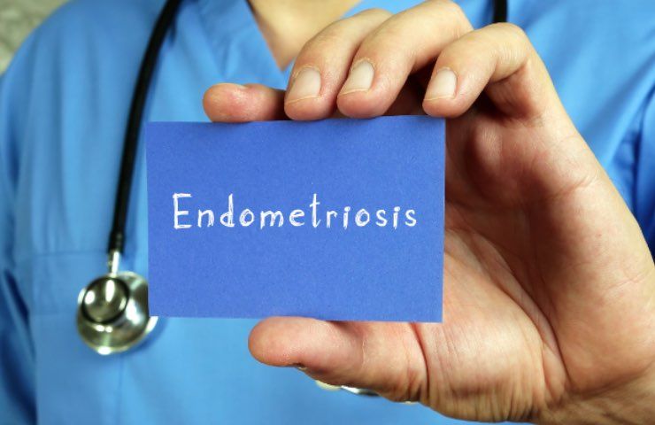 endometriosi trattamento naturale integratori