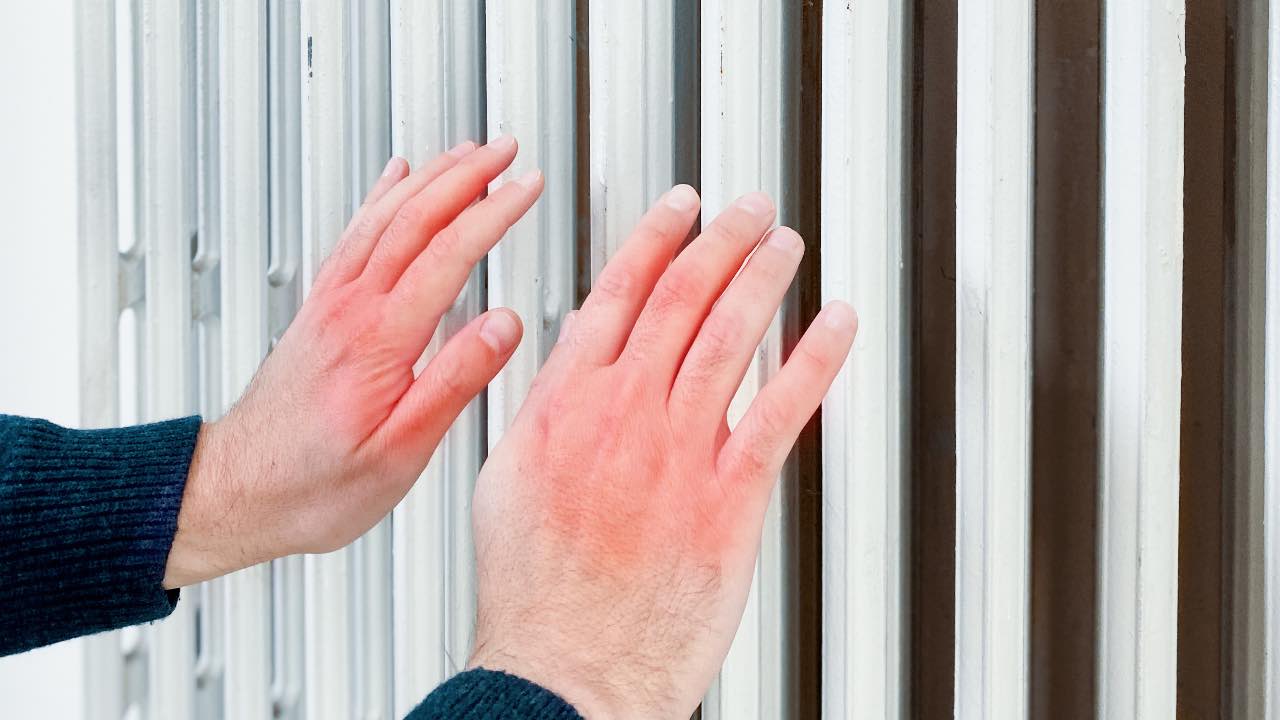 rimedi naturali curare geloni