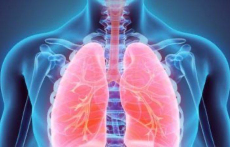 tubercolosi polmoni danneggiati